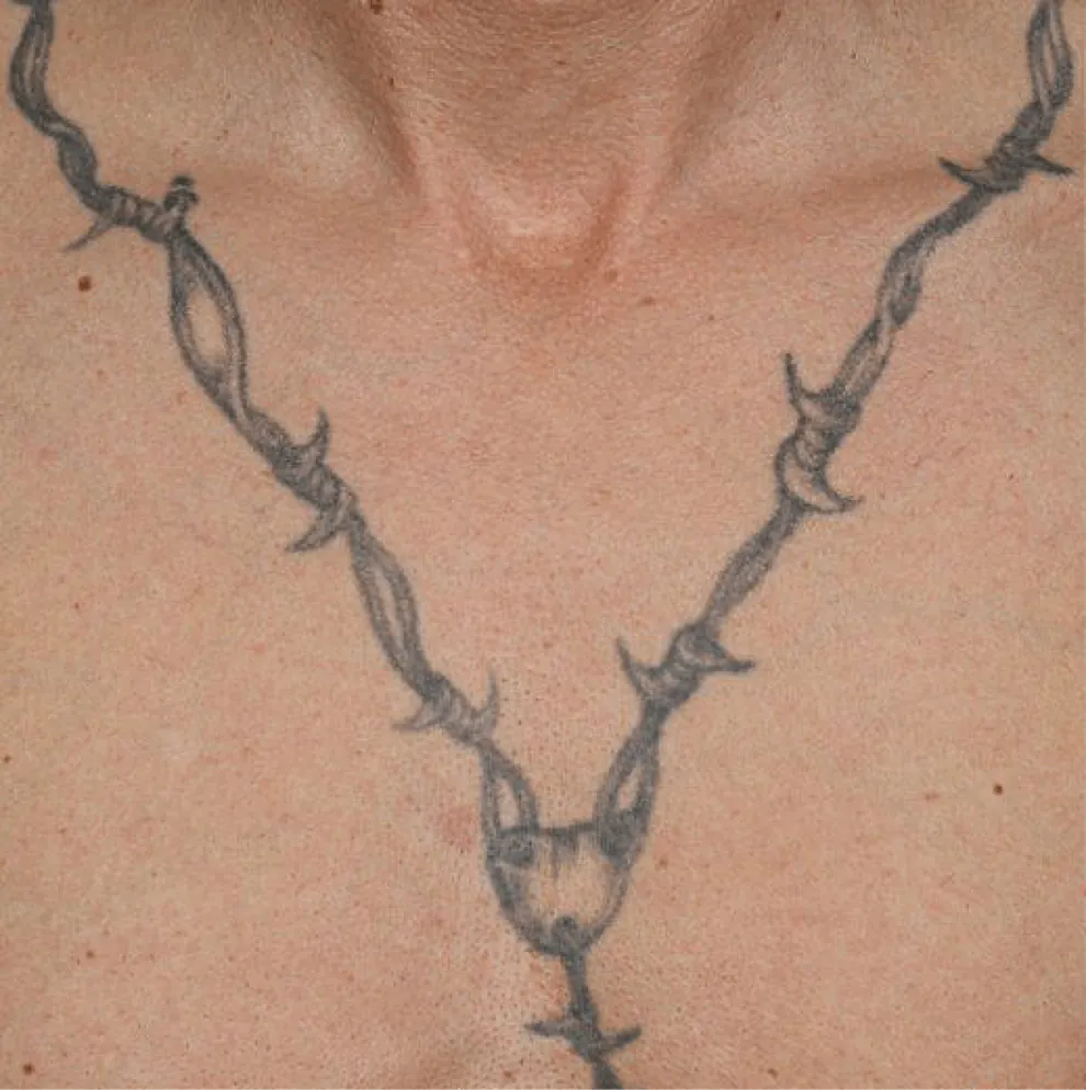 Barbed-wire chain tattoo on the chest